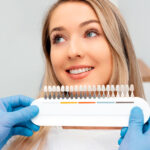 a woman receiving color matching for her veneers